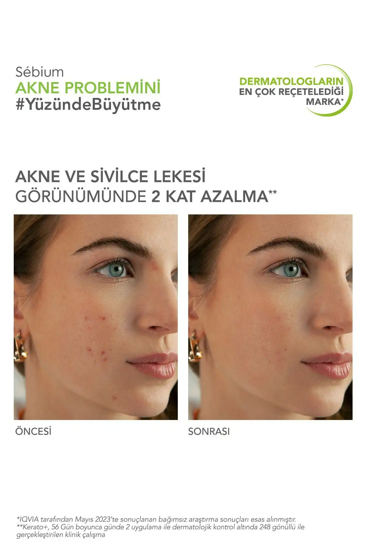 کرم ژل کراتو سبیوم 30 میلی لیتر برند   Bioderma(بیودرما) در دسته مراقبت از پوست