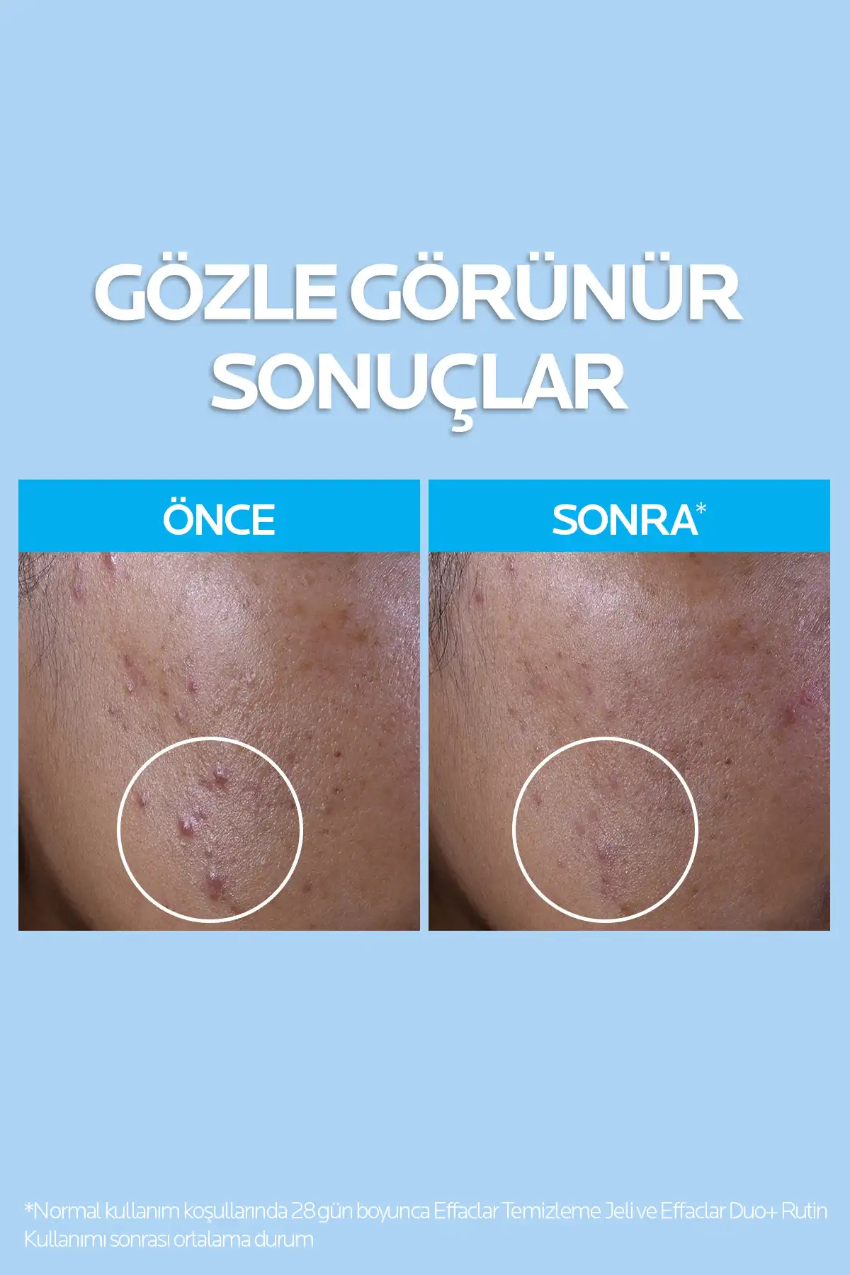 ست پاک کننده ملایم و سفت کننده منافذ پوست Effaclar برای پوست های چرب برند   La Roche Posay(لاروش پوسای) به رنگ   در دسته ست مراقبت از پوست